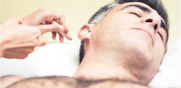 acupuncture for whiplash